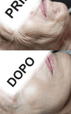 prima e dopo 7.jpg