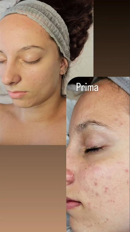 prima e dopo