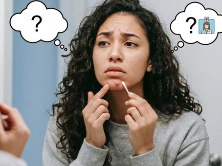 Ho un Brufolo o Qualcosa di Più? Ecco Quando Preoccuparti Davvero (e Come Risolvere)
